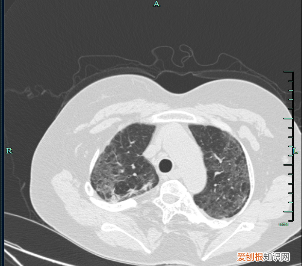 种植灵芝吃了有用吗