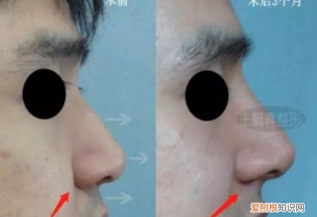 欧阳娜娜的鼻子是塌鼻子吗,欧阳娜娜鼻子侧脸