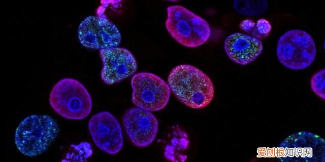 为什么消毒酒精浓度必须是75 浓度越高的酒精消毒杀菌越好吗