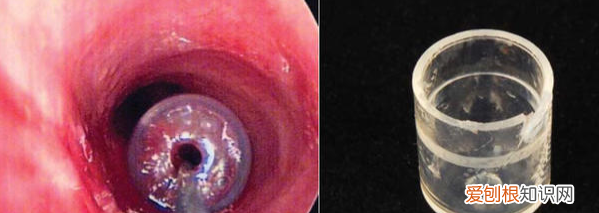 原来笔帽上的小孔也是救命孔