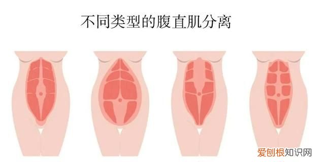 腹直肌分离还可以练出腹肌吗,腹直肌分离怎么练腹肌
