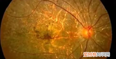 黑桑葚怎么辨别加了色素,黑桑葚染色是什么样的