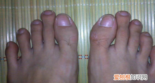 二母脚指比大母指长怎么说,女生脚二拇指比大拇指长代表什么