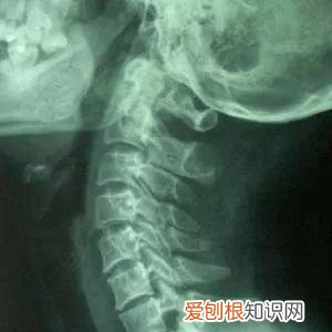 奥特曼b超图