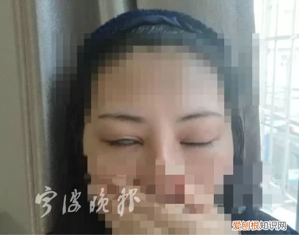 济南割双眼皮最好的医院
