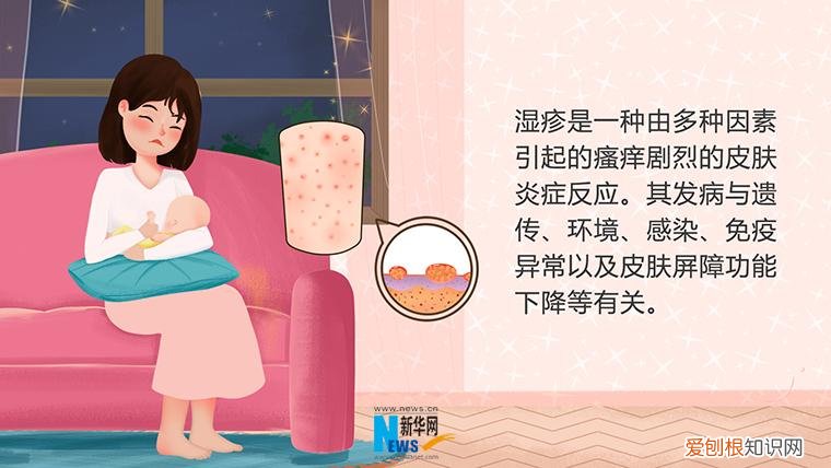 婴儿 湿疹