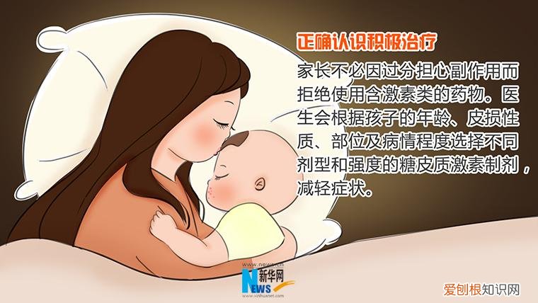 婴儿 湿疹