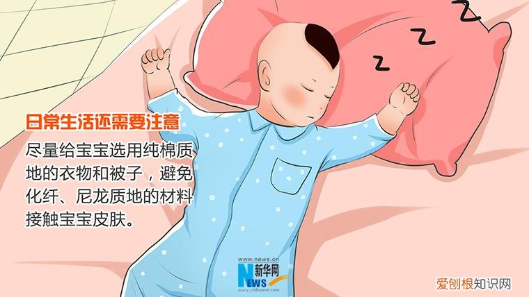 婴儿 湿疹