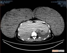 怀孕罩杯可能从a到d么