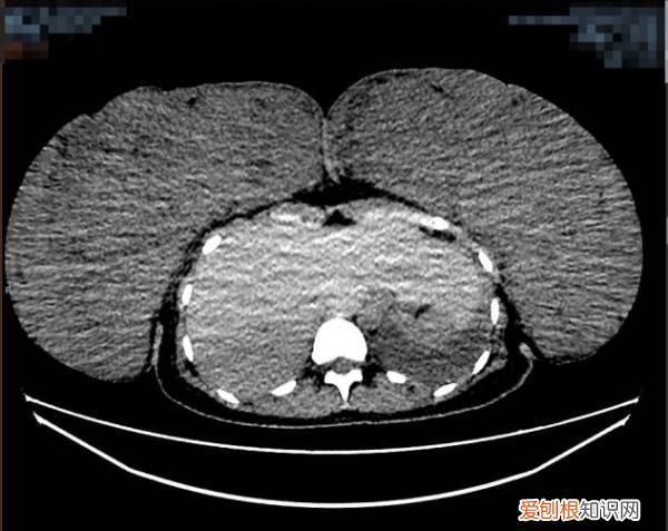怀孕罩杯可能从a到d么