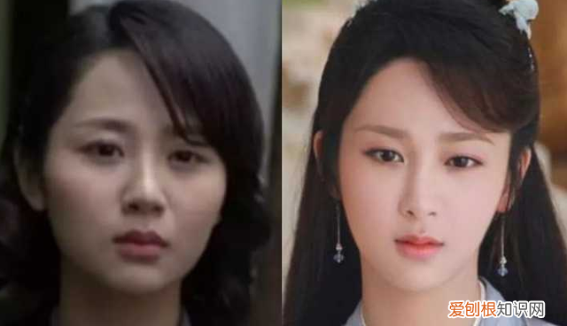 颧骨内推能推平吗 颧骨内推不建议推平