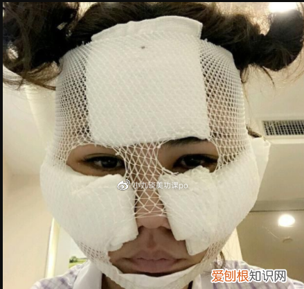 颧骨内推能推平吗 颧骨内推不建议推平