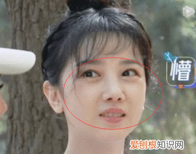 颧骨内推能推平吗 颧骨内推不建议推平