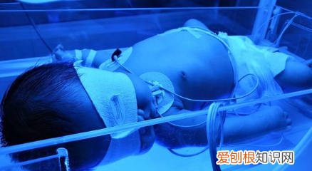 黄疸照蓝光是什么原理，黄疸高为什么要照蓝光