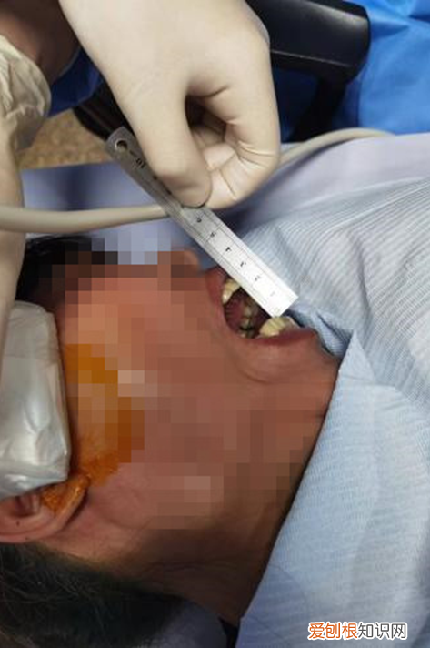 麻花疼是什么意思