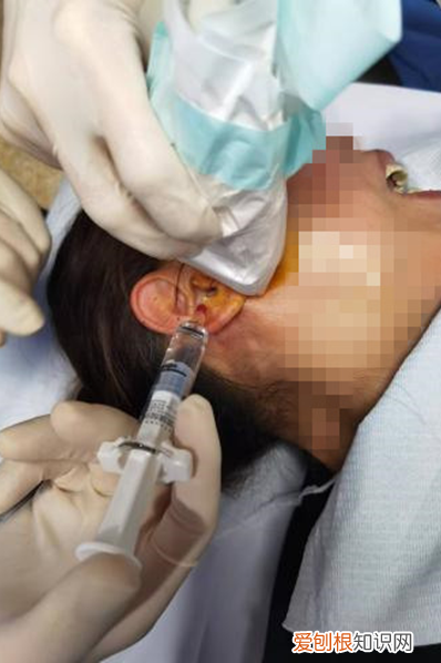 麻花疼是什么意思