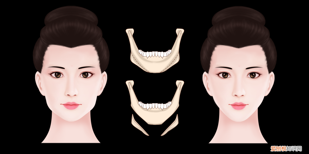 麻花疼是什么意思