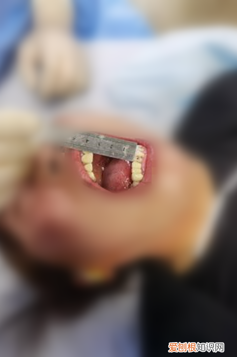 麻花疼是什么意思