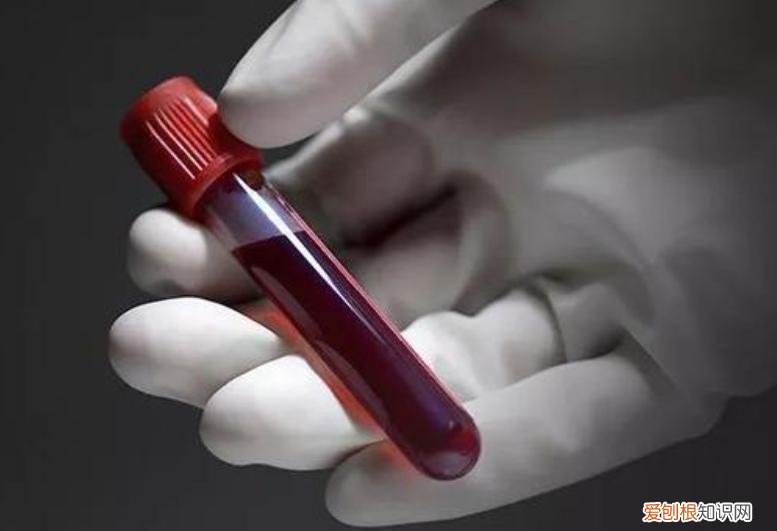 男性中性粒细胞百分比偏高的原因