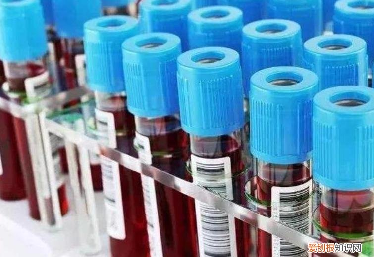 男性中性粒细胞百分比偏高的原因