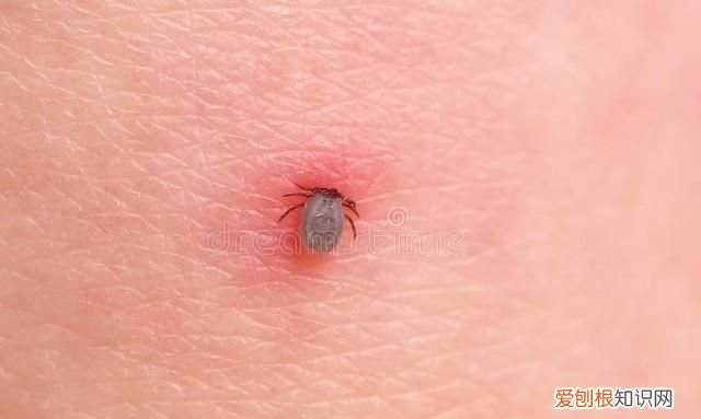 蠓虫叮咬奇痒无比怎么止痒 广东蠓虫咬人太痒了