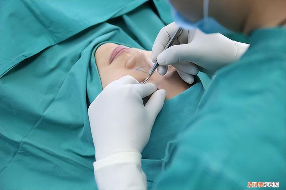 戚薇素颜照对比