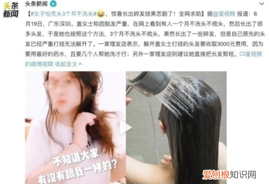 治脱发最好的药( 治脱发的正确操作看这里)