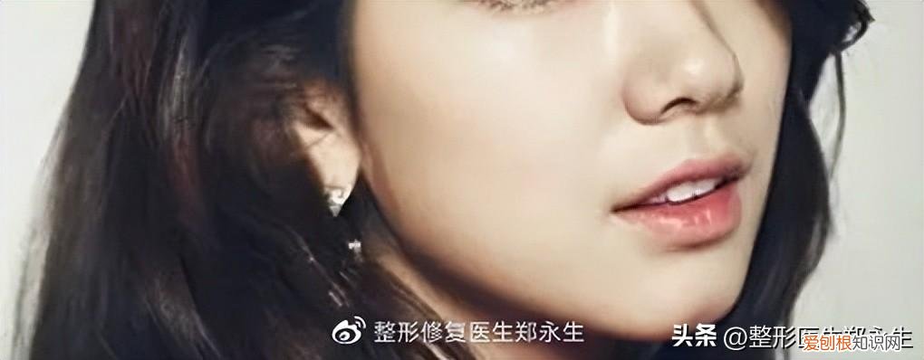 鼻头缩小手术的费用大概是多少啊