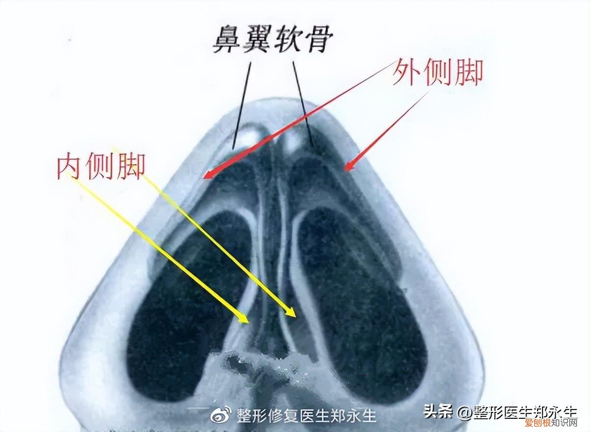 鼻头缩小手术的费用大概是多少啊