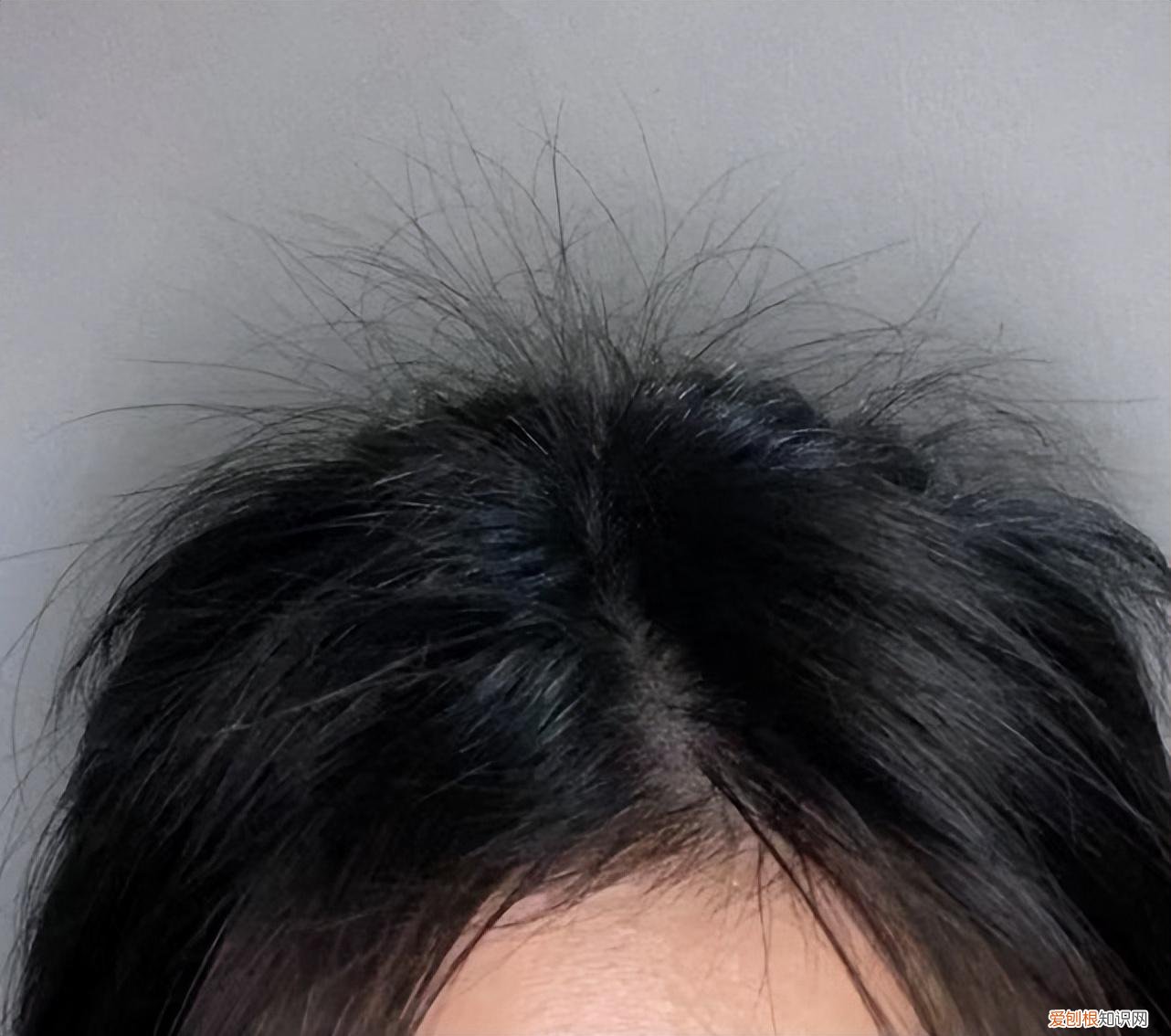 防脱发洗发水哪个好用