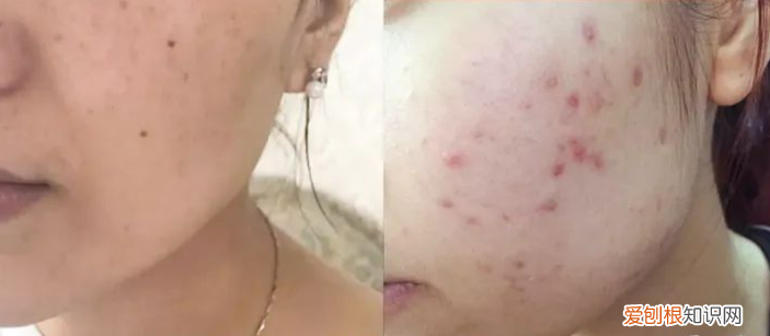 olay玉兰油美白套盒