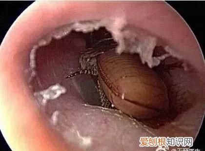 男子三天没睡觉去医院一查崩溃了