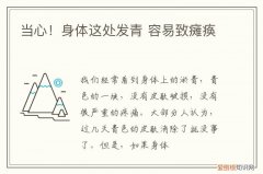 当心！身体这处发青 容易致瘫痪