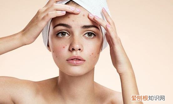 脸上痘痘多影响个人颜值 14个偏方轻松甩掉痘痘