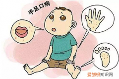 手足口病不吃药能自愈吗 小儿手足口病的家庭护理有哪些