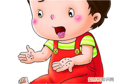 引起手足口病的病毒有哪些 为什么婴幼儿是易感人群