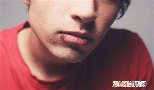 嘴上起泡怎样快速下去嘴上起泡可以涂牙膏吗