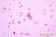 宠物得弓形虫，[宠物知识科普]《人畜共患之弓形虫病》
