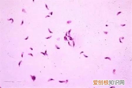 宠物得弓形虫，[宠物知识科普]《人畜共患之弓形虫病》