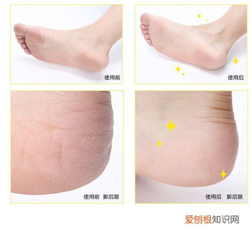 修脚器哪个牌子好 3款不错的修脚器品牌推荐