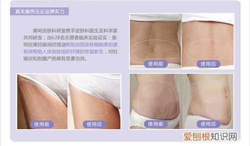 小偏方:去疤痕精油的功效及使用方法，去疤精油怎么使用