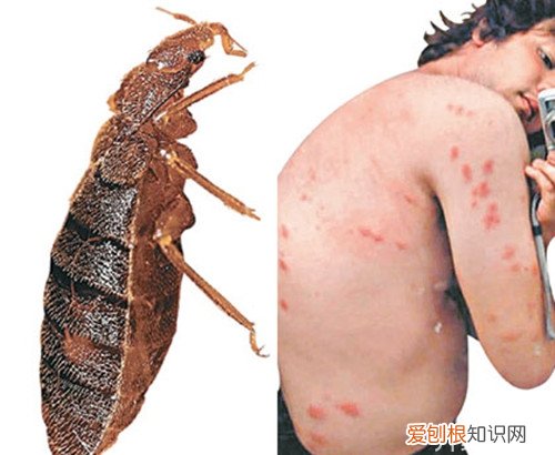 【生活资讯】臭虫咬了怎么治简单实用,不看别后悔！