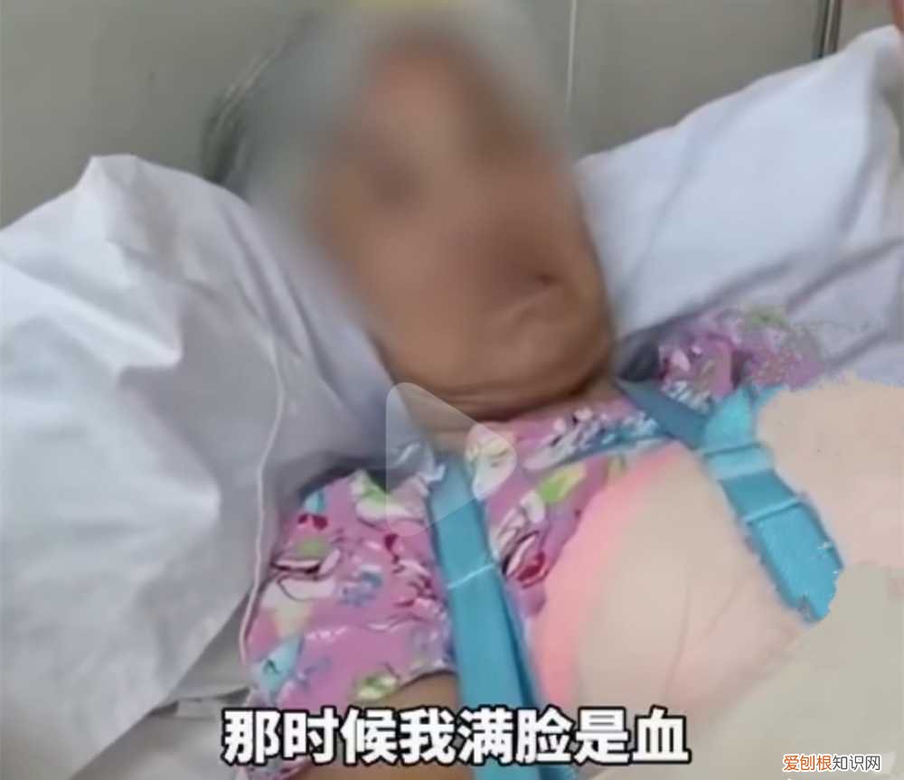遵义狗咬死老人 贵阳发生恶犬伤人事件，小狗被咬死，老人全身被咬伤