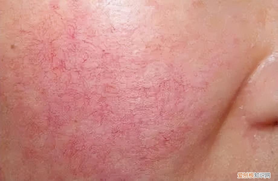 hr赫莲娜小绿瓶适合什么年龄的用?