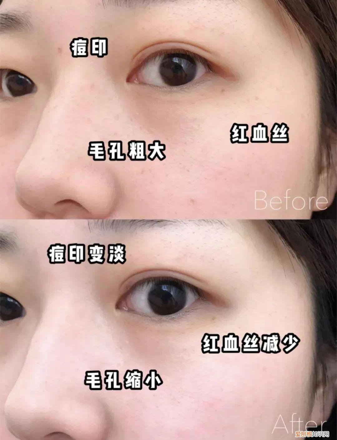 hr赫莲娜小绿瓶适合什么年龄的用?