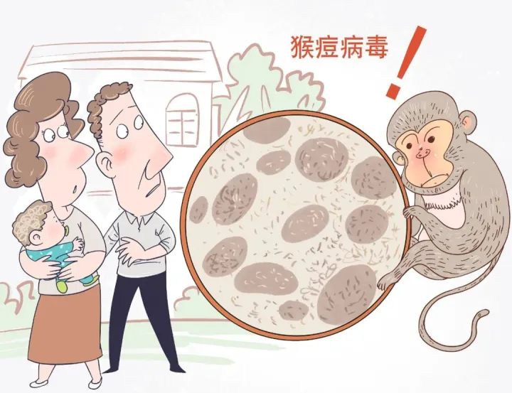 怎么判断长的是不是疣,猴痘科普小知识丨微生物的那些事儿
