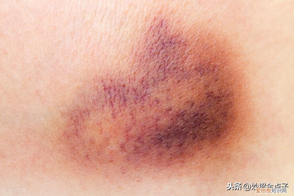 关于生活中容易被忽视的常识是什么，掌握13种最实用常见生活常识，赶走认知上的误区，方法简单有效