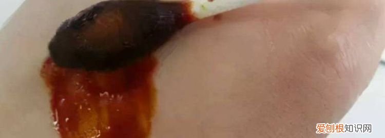 碘酒怎么弄掉不留痕迹 ，碘酒怎么洗掉？