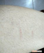 狗狗被野猫抓伤怎么办，狗眼睛被猫抓伤了怎么办