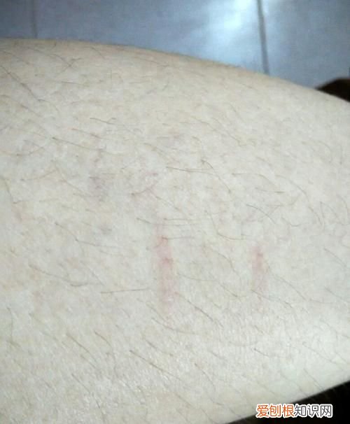 狗狗被野猫抓伤怎么办，狗眼睛被猫抓伤了怎么办